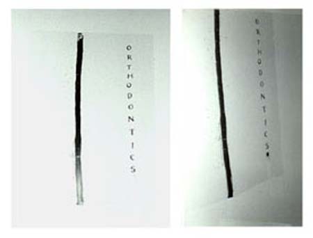 orthodontics